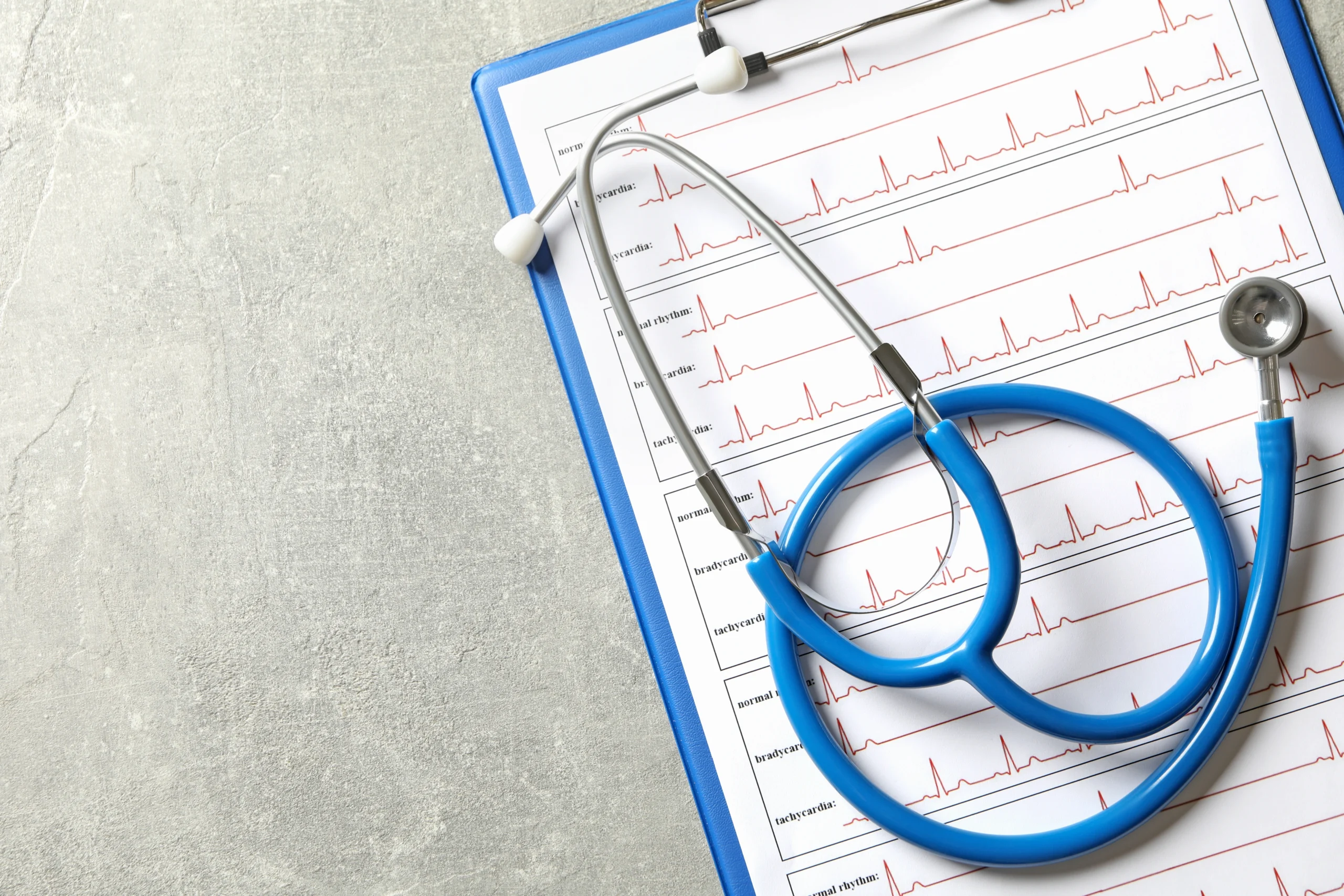 stethoscope-on-an-ekg-chart-for-medical-use-2026-03-24-22-43-46-utc